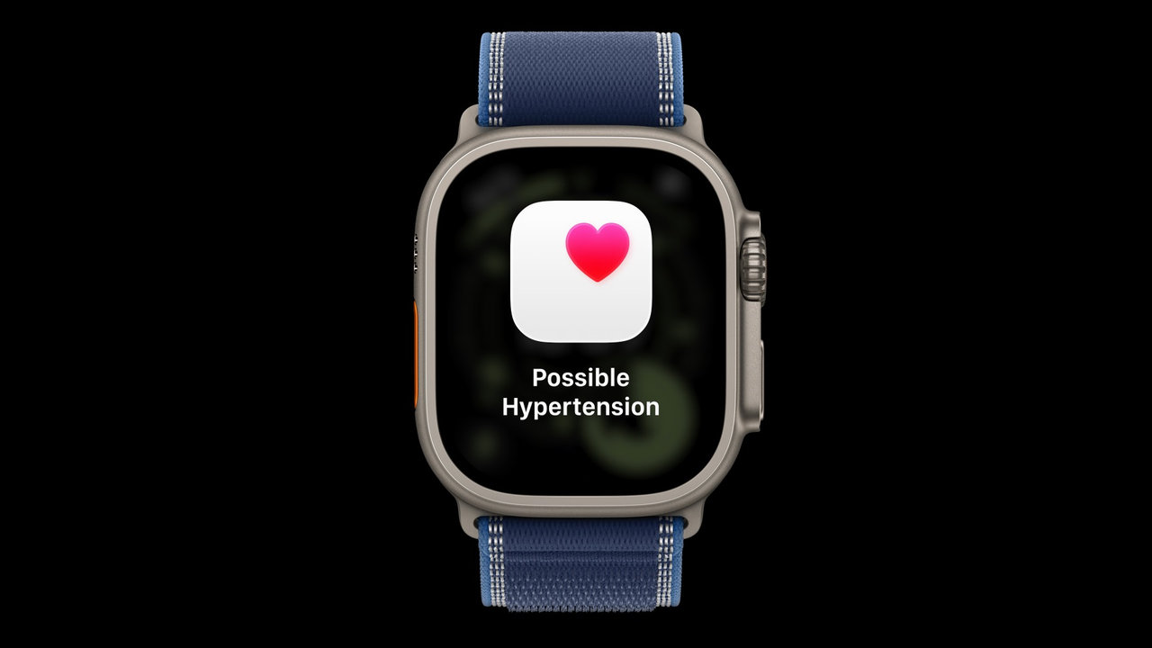 Chytré hodinky Apple Watch Ultra 3 (2025) sledování zdraví